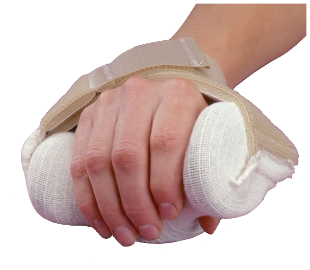 Rolyan Carve-It Hand Splint S/M