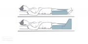 Gutter Leg Carriage 