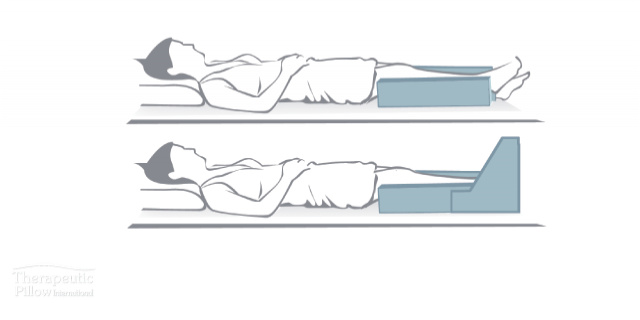 Gutter Leg Carriage 